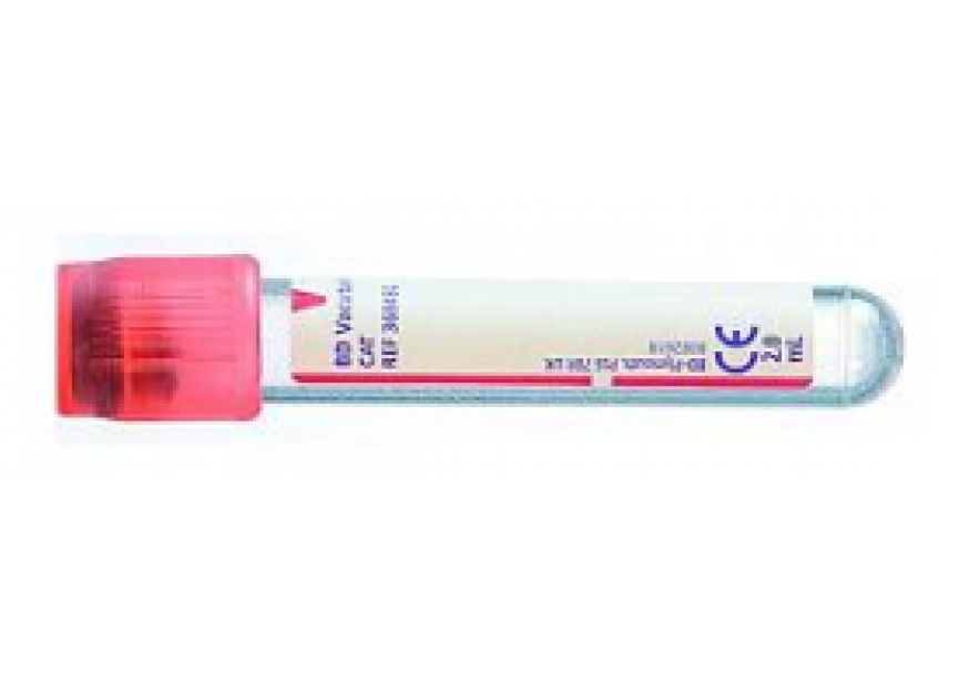 VACUTAINER TUBE ROOD DROOG 2ML